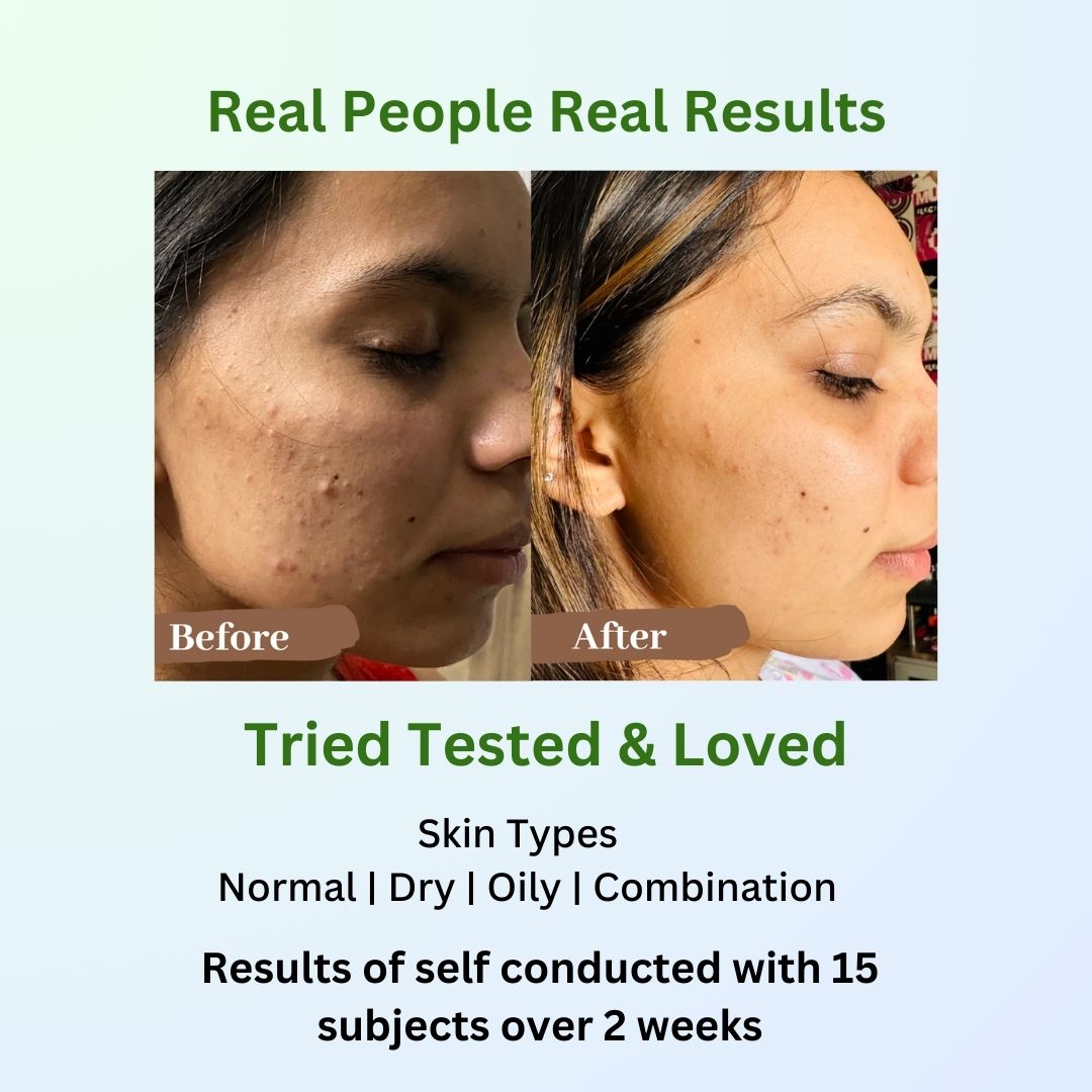 Skindae Before & After face wash.jpg